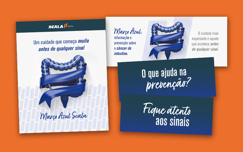 Card com colagem de cartazes de Ações internas na logística
